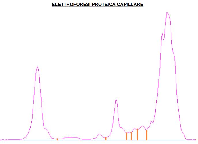 Elettroforesi sierica e FIP