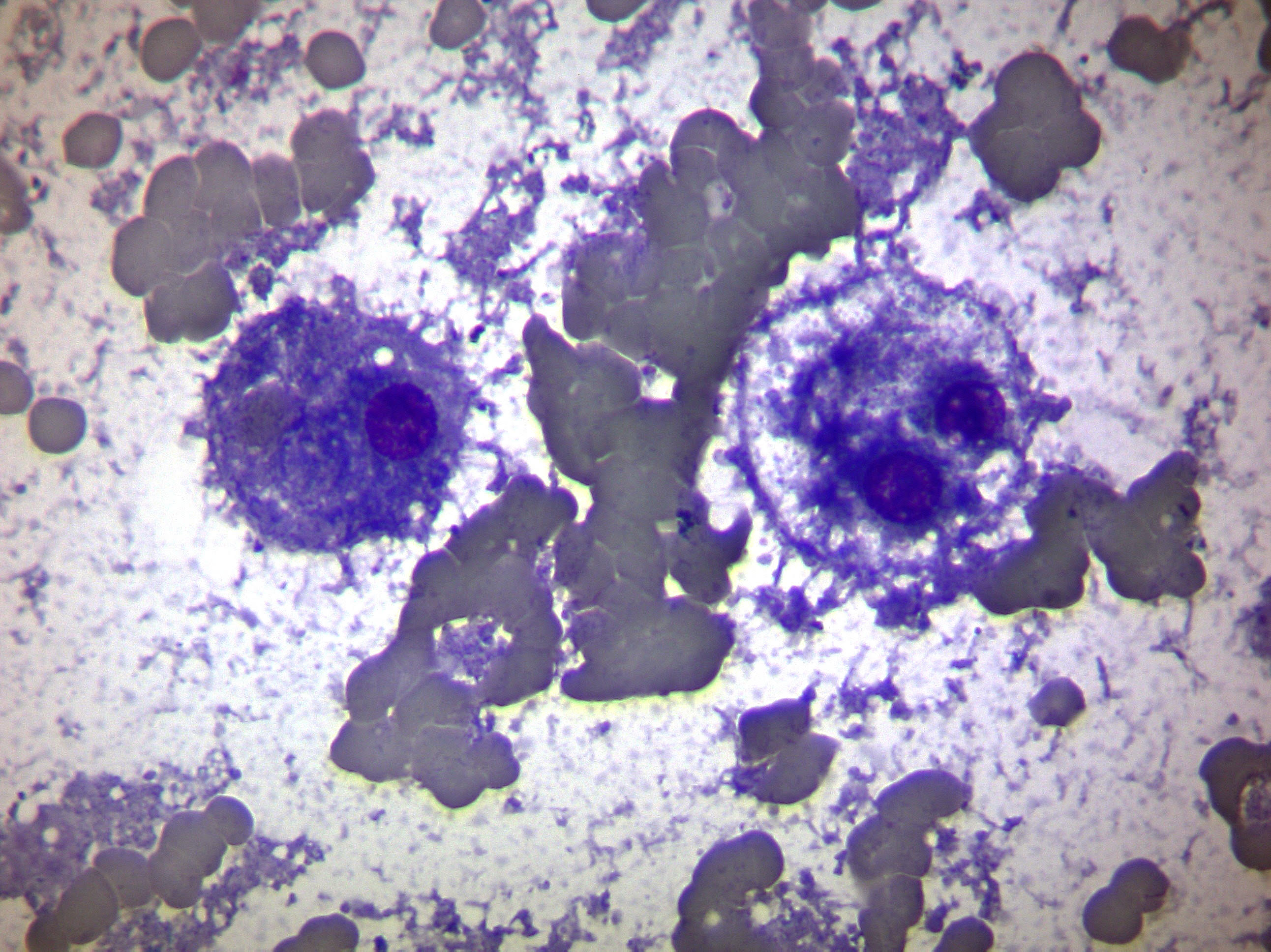 Come sfruttare le colorazioni speciali in citologia epatica