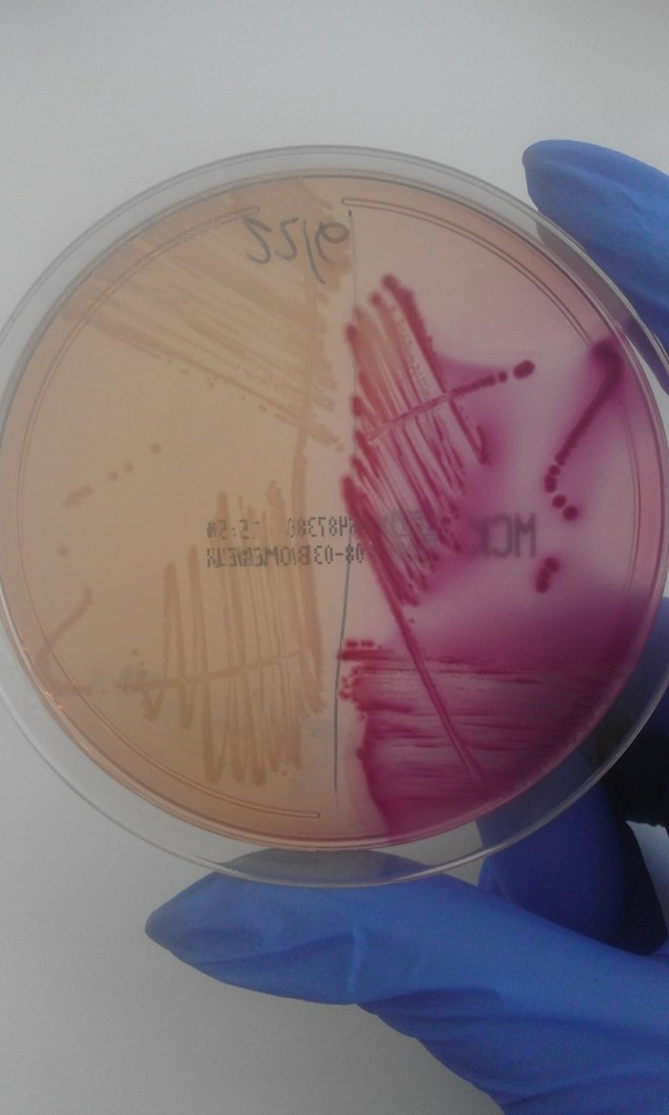 Il campionamento in microbiologia - 1^ parte